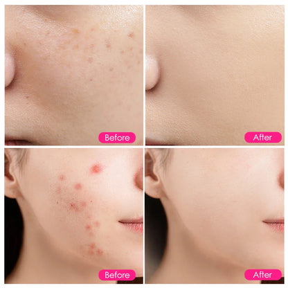 LED Red Light Face Mask Beauty Device